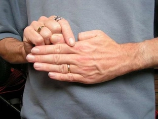 Baş Parmak Çıkması Belirtileri ve Tedavisi